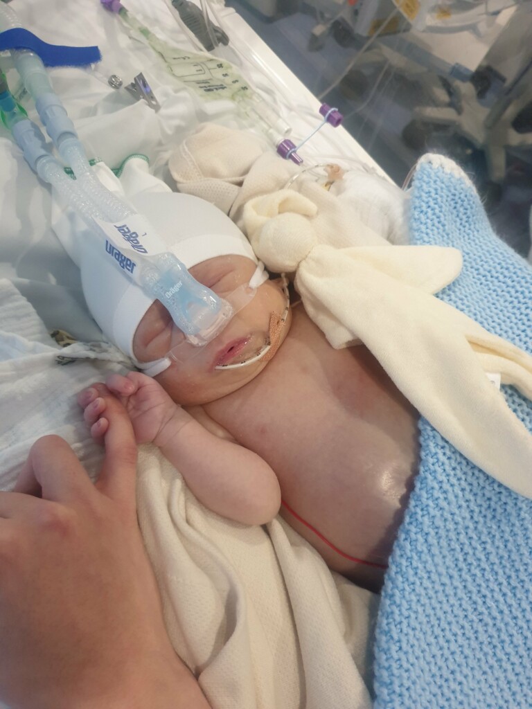 Baby Jaxon in St Michael's Neonatal Intensive Care Unit.
