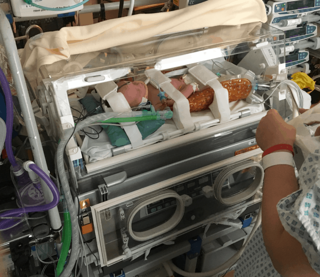 Rory in an incubator in St Michael's Hospital NICU