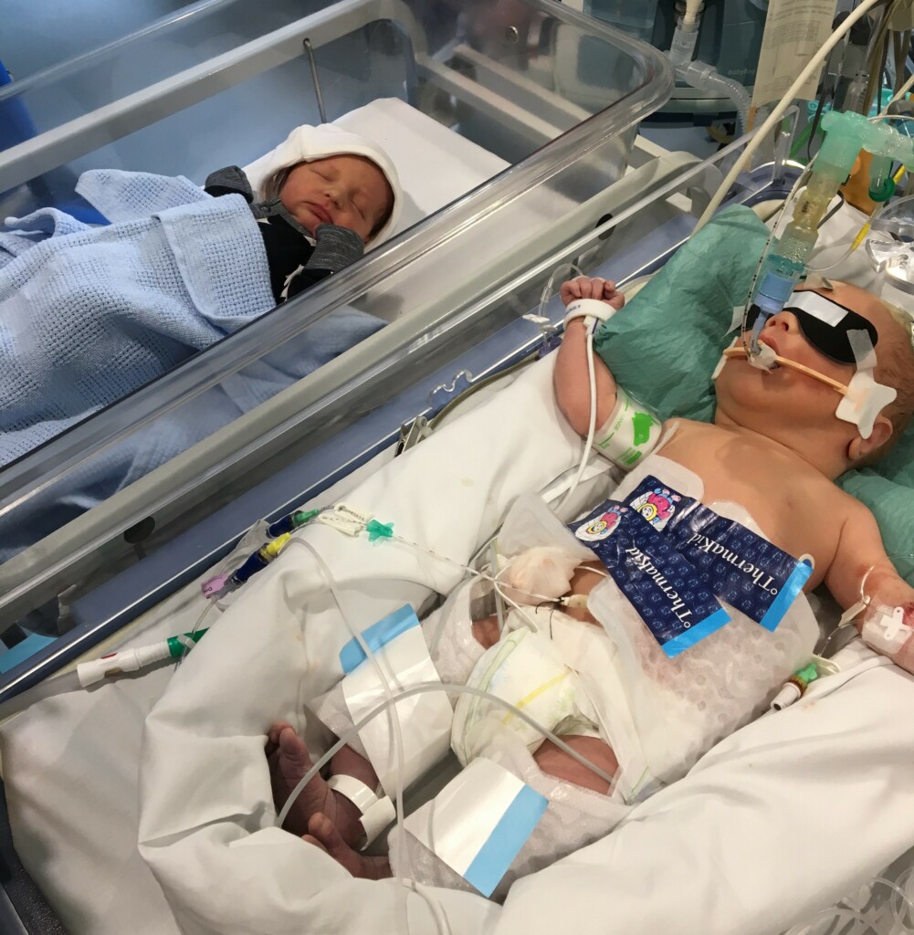 Twins Oscar and Rory pictured in St Michael's Neonatal Intensive Care Unit (NICU). 
