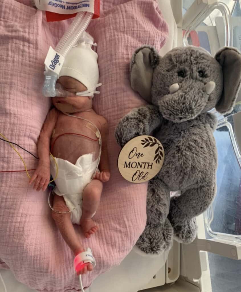 Emmy at one month old, next to a stuffed toy elephant. She is very small, with an oxygen mask on her face.