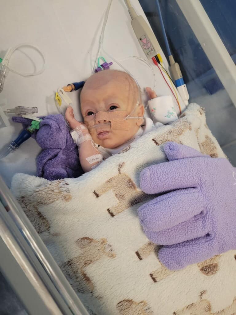 Jade in care at St Michael's Neonatal Intensive Care Unit, Bristol. 