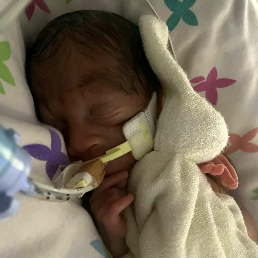 Joey at 14 days old in St Michael's Neonatal Intensive Care Unit, Bristol. 