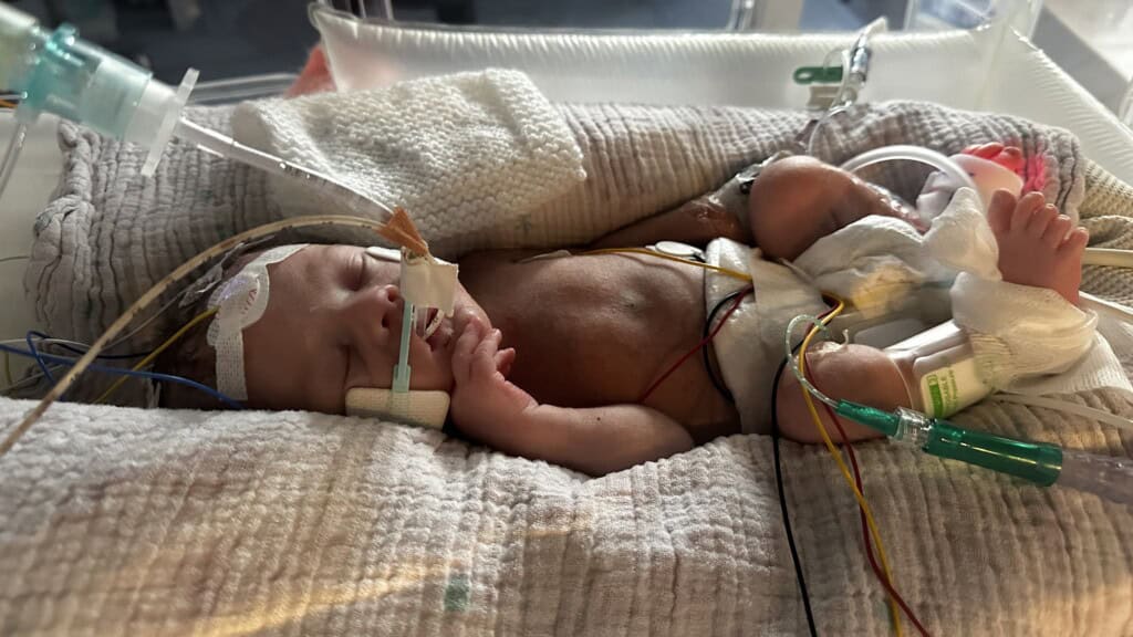 Baby Reid in his incubator.