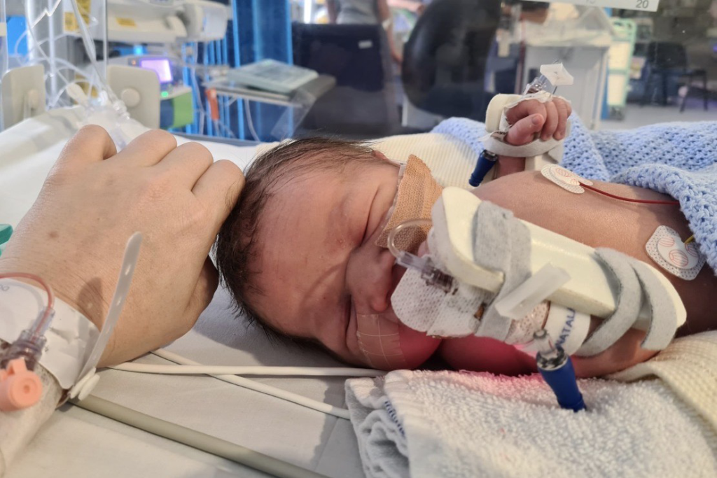 Miles in intensive care as a baby.