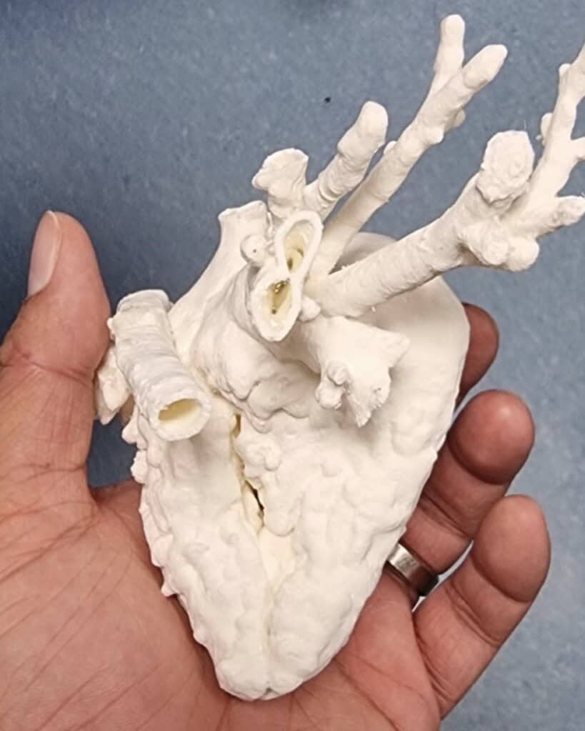 Miles' 3D-printed heart.